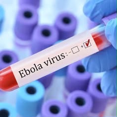 FG Confirms Ebola Case in FCT, Identifies 44 Contacts of Infected Woman
